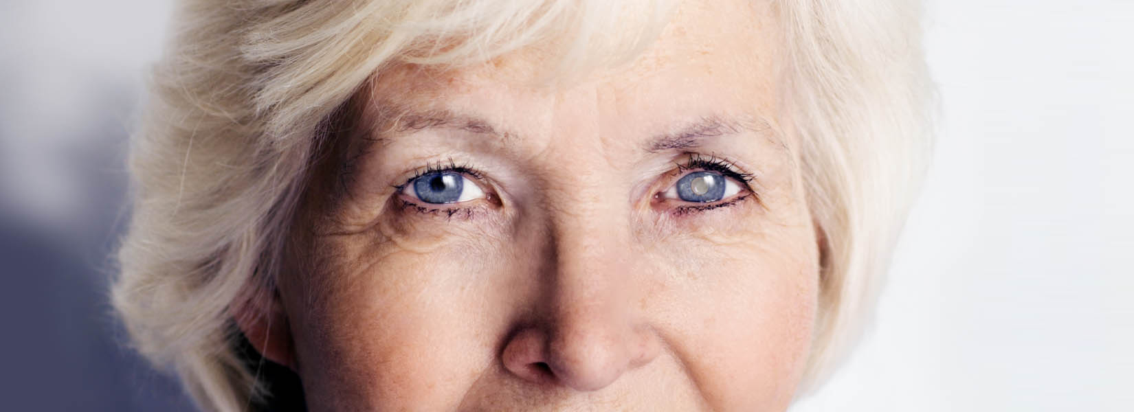 Cataract Surgery in Strongsville
